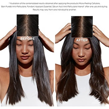 Kerastase Symbiose Intense Revitalizing Mask (Damaged hair prone to dandruff) 200ml